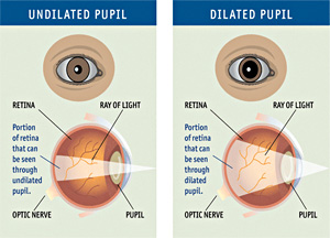 What does it mean when someone looks at you with dilated pupils?